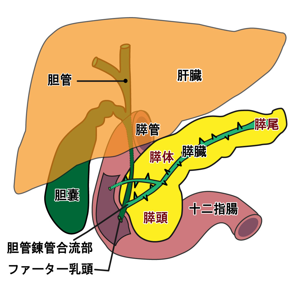 胆嚢 ポリープ 原因
